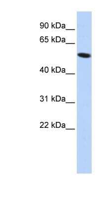 Western Blot: ZNF572 Antibody [NBP1-80157] - HepG2 cell lysate, concentration 0.2-1 ug/ml.