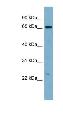 Western Blot: ZNF572 Antibody [NBP1-80407] - COLO205 cells lysate, concentration 0.2-1 ug/ml.