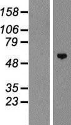 Western Blot: ZNF572 Overexpression Lysate (Adult Normal) [NBP2-05383] Left-Empty vector transfected control cell lysate (HEK293 cell lysate); Right -Over-expression Lysate for ZNF572.