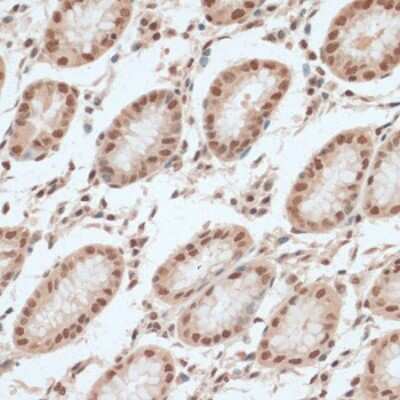 Immunohistochemistry-Paraffin ZNF574 Antibody - Azide and BSA Free