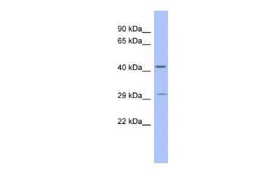Western Blot: ZNF575 Antibody [NBP2-83880] - WB Suggested Anti-ZNF575 Antibody Titration: 0.2-1 ug/ml. ELISA Titer: 1:1562500. Positive Control: Human Stomach
