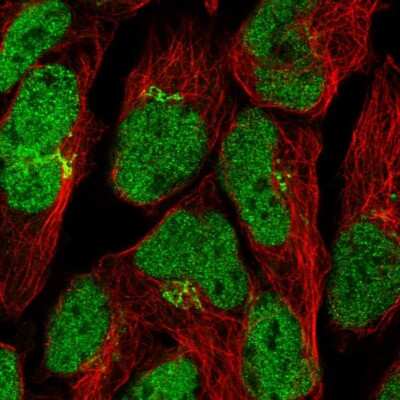 Immunocytochemistry/ Immunofluorescence ZNF576 Antibody - BSA Free