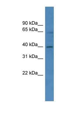 Western Blot: ZNF579 Antibody [NBP1-68922] - Hela cell lysate, concentration 0.2-1 ug/ml.