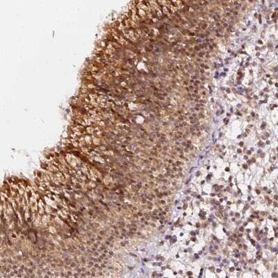 Immunohistochemistry-Paraffin: ZNF580 Antibody [NBP2-47565] - Staining of nasopharynx tissue. Shows strong cytoplasmic and nuclear positivity in respiratory epithelial cells.