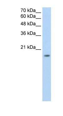 Western Blot: ZNF580 Antibody [NBP1-80333] - Titration: 0.2-1 ug/ml, Positive Control: Jurkat cell lysate.