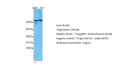 Western Blot: ZNF580 Antibody [NBP1-80333] - Host: Rabbit. Target: ZNF580. Positive control (+): RPMI-8226 (N12). Negative control (-): U937 (N31). Antibody concentration: 3ug/ml