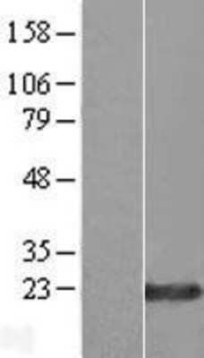 Western Blot: ZNF580 Overexpression Lysate (Adult Normal) [NBL1-18196] Left-Empty vector transfected control cell lysate (HEK293 cell lysate); Right -Over-expression Lysate for ZNF580.