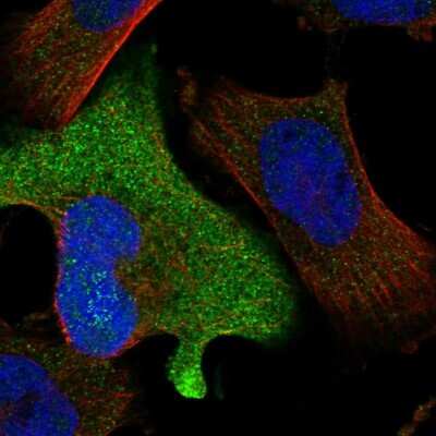Immunocytochemistry/Immunofluorescence: ZNF582 Antibody [NBP1-82033] - Immunofluorescent staining of human cell line U-251 MG shows localization to cytosol.