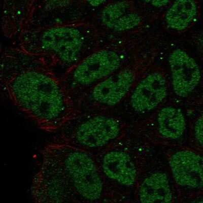 Immunocytochemistry/ Immunofluorescence ZNF585B Antibody - BSA Free