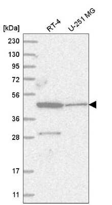 Western Blot: ZNF586 Antibody [NBP2-56434] - Western blot analysis in human cell line RT-4 and human cell line U-251 MG.