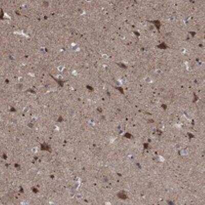 Immunohistochemistry-Paraffin ZNF594 Antibody - BSA Free