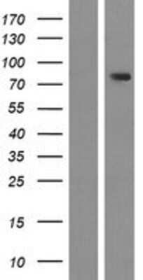 Western Blot: ZNF595 Overexpression Lysate (Adult Normal) [NBP2-04853] Left-Empty vector transfected control cell lysate (HEK293 cell lysate); Right -Over-expression Lysate for ZNF595.