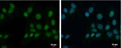 Immunocytochemistry/Immunofluorescence: ZNF596 Antibody [NBP2-21032] - NT2D1 cells were fixed in 4% paraformaldehyde at RT for 15 min. Green: ZNF596 protein stained by ZNF596 antibody [N1N3] diluted at 1:500. Blue: Hoechst 33342 staining. Scale bar = 10 um.