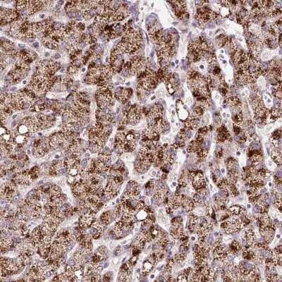 Immunohistochemistry-Paraffin: ZNF596 Antibody [NBP2-49183] - Staining of human liver shows strong cytoplasmic positivity in granular pattern in hepatocytes.