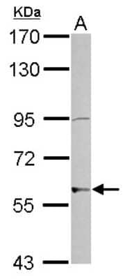 Western Blot: ZNF596 Antibody [NBP2-21032] - Sample (30 ug of whole cell lysate) A: NT2D1 7. 5% SDS PAGE gel, diluted at 1:2000.