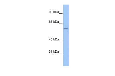 Western Blot: ZNF596 Antibody [NBP2-86528] - WB Suggested Anti-ZNF596 Antibody Titration: 0.2-1 ug/ml. ELISA Titer: 1:312500. Positive Control: Hela cell lysate