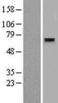 Western Blot: ZNF596 Overexpression Lysate (Adult Normal) [NBP2-09227] Left-Empty vector transfected control cell lysate (HEK293 cell lysate); Right -Over-expression Lysate for ZNF596.