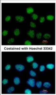 Immunocytochemistry/Immunofluorescence: ZNF597 Antibody [NBP2-21033] - Analysis of paraformaldehyde-fixed A431, using ZNF597 antibody at 1:500 dilution