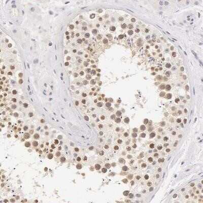 Immunohistochemistry-Paraffin ZNF597 Antibody