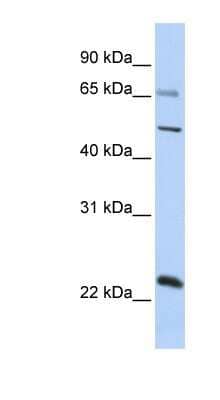 Western Blot: ZNF597 Antibody [NBP1-80158] - Human Placenta lysate, concentration 0.2-1 ug/ml.