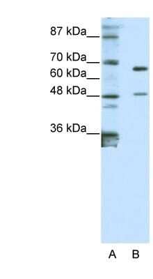 Western Blot: ZNF597 Antibody [NBP1-80408] - Titration: 0.2-1 ug/ml, Positive Control: Jurkat cell lysate.