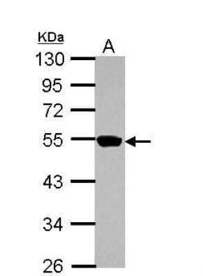 Western Blot: ZNF597 Antibody [NBP2-21033] - Sample (30 ug of whole cell lysate)  A: A431 10% SDS PAGE  diluted at 1:1000