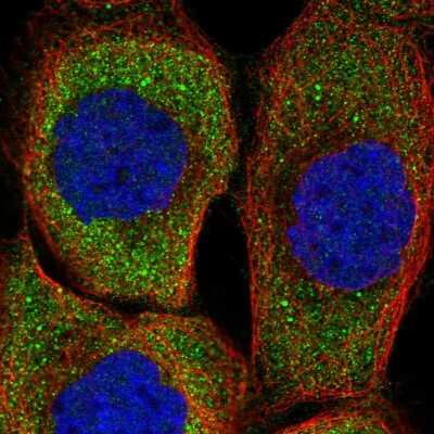 Immunocytochemistry/ Immunofluorescence ZNF598 Antibody