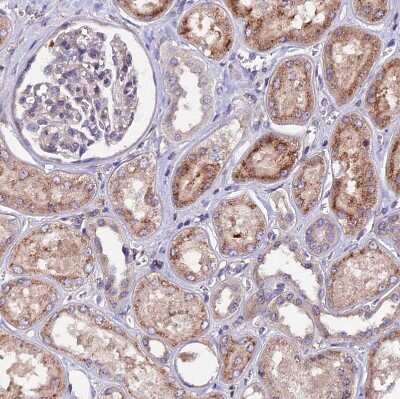 Immunohistochemistry-Paraffin ZNF598 Antibody