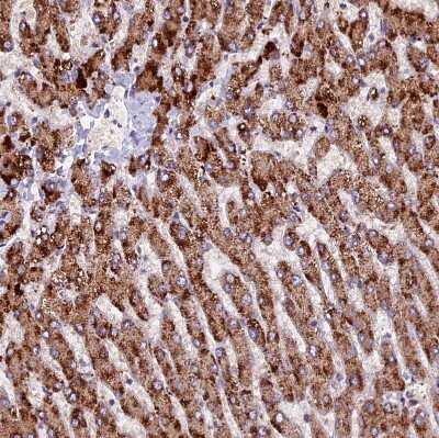 Immunohistochemistry-Paraffin ZNF598 Antibody