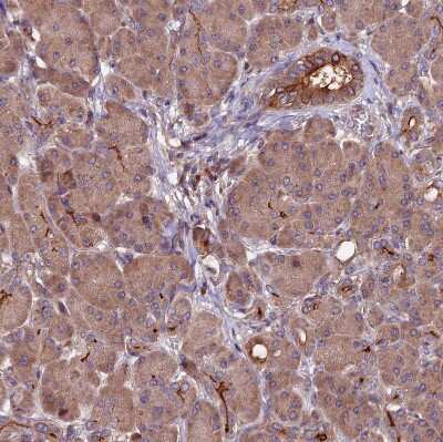 Immunohistochemistry-Paraffin ZNF598 Antibody - BSA Free