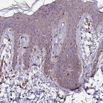 Immunohistochemistry-Paraffin ZNF598 Antibody - BSA Free