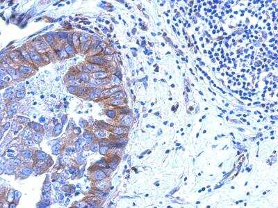 Immunohistochemistry-Paraffin ZNF598 Antibody - Azide Free