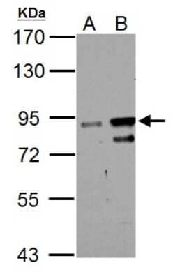 Western Blot: ZNF598 Antibody [NBP2-21034] - Sample (30 ug of whole cell lysate) A: HL-60 B: NCI-H929 7. 5% SDS PAGE gel, diluted at 1:1000.