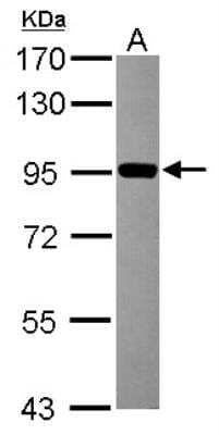 Western Blot ZNF598 Antibody - Azide Free