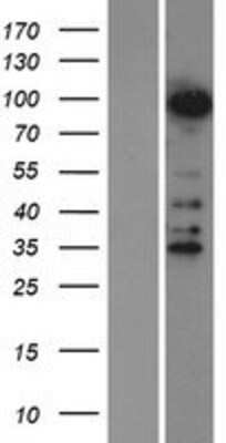 Western Blot ZNF598 Overexpression Lysate