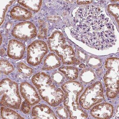 Immunohistochemistry: ZNF605 Antibody [NBP2-46868] - Staining of human kidney shows moderate cytoplasmic positivity in cells in tubules.