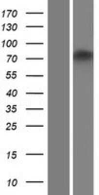 Western Blot: ZNF605 Overexpression Lysate (Adult Normal) [NBP2-04780] Left-Empty vector transfected control cell lysate (HEK293 cell lysate); Right -Over-expression Lysate for ZNF605.