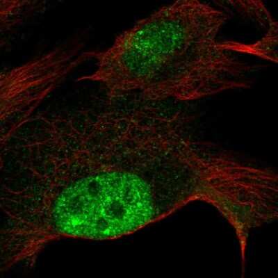 Immunocytochemistry/ Immunofluorescence ZNF606 Antibody - BSA Free