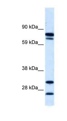 Western Blot: ZNF606 Antibody [NBP1-80028] - Human kidney lysate, concentration 0.2-1 ug/ml.