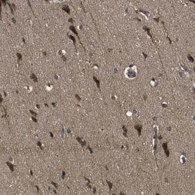 Immunohistochemistry-Paraffin: ZNF608 Antibody [NBP1-85109] - Staining of human cerebral cortex shows  moderate cytoplasmic positivity in neurons.