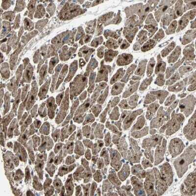 Immunohistochemistry-Paraffin: ZNF608 Antibody [NBP1-85109] - Staining of human heart muscle shows strong granular cytoplasmic positivity in cardiomyocytes.