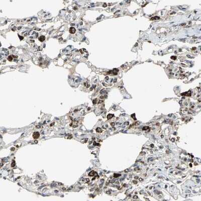 Immunohistochemistry-Paraffin: ZNF608 Antibody [NBP1-85109] - Staining of human lung shows strong cytoplasmic positivity in pneumocytes.