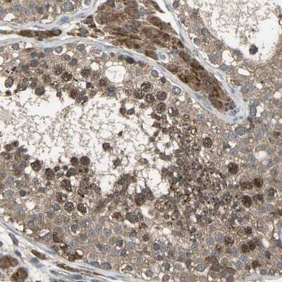 Immunohistochemistry-Paraffin: ZNF608 Antibody [NBP1-85109] - Staining of human testis shows moderate granular cytoplasmic positivity in cells in seminiferous ducts and leydig cells.