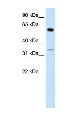Western Blot ZNF609 Antibody - BSA Free