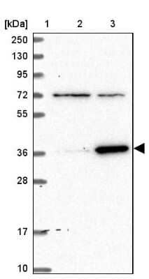 Western Blot ZNF609 Antibody - BSA Free