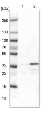 Western Blot ZNF609 Antibody - BSA Free
