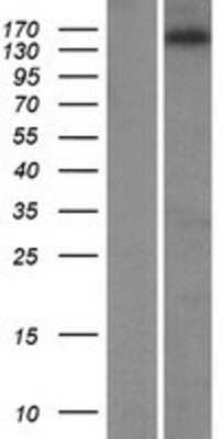 Western Blot: ZNF609 Overexpression Lysate (Adult Normal) [NBP2-07225] Left-Empty vector transfected control cell lysate (HEK293 cell lysate); Right -Over-expression Lysate for ZNF609.