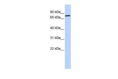 Western Blot: ZNF613 Antibody [NBP2-83885] - WB Suggested Anti-ZNF613 Antibody Titration: 0.2-1 ug/ml. ELISA Titer: 1:12500. Positive Control: Hela cell lysate