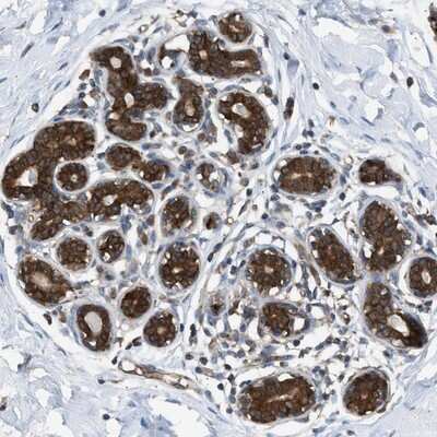 Immunohistochemistry-Paraffin ZNF614 Antibody - BSA Free
