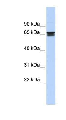Western Blot ZNF614 Antibody - BSA Free